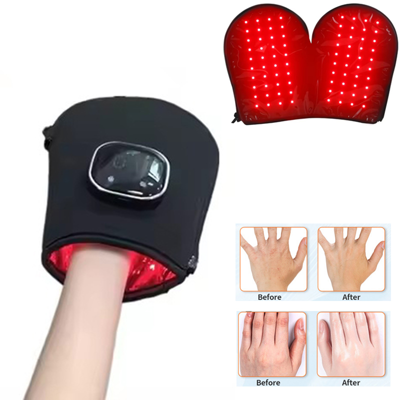Perangkat Terapi Cahaya Merah  - Heated Gloves Electric ulasan dan harga